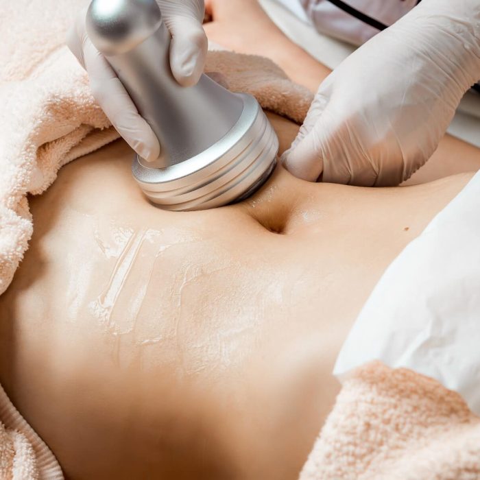 Ultrasound Cavitation+ RF+ Low level Red light therapy